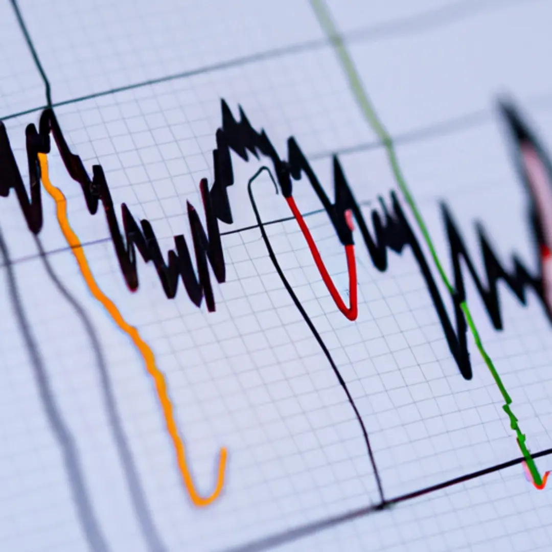 Image of a graph depicting the fluctuation of interest rates over time.